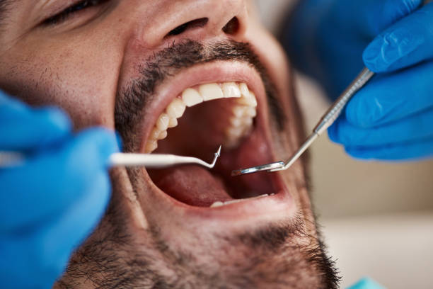 Best Emergency Treatment for Jaw Pain or Injury in Park Forest, IL