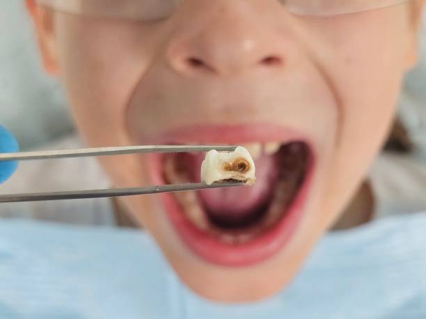 Best Emergency Root Canal Therapy in Park Forest, IL